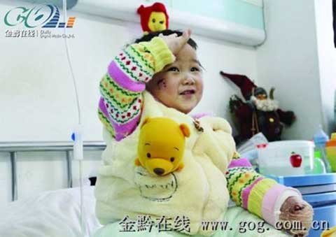 Bố cắn đứt ngón tay con lúc say rượu