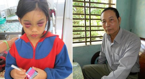Cháu bé bị đánh dã man từng bị rao bán 50 triệu?