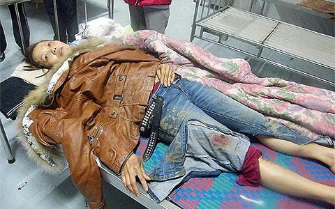 Ghen tuông, 3 chị em lột đồ người khác