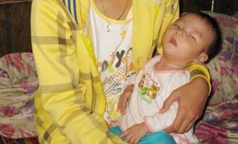 Tội lắm bé 13 tháng tuổi: mắc tim bẩm sinh, nguy cơ mù lòa