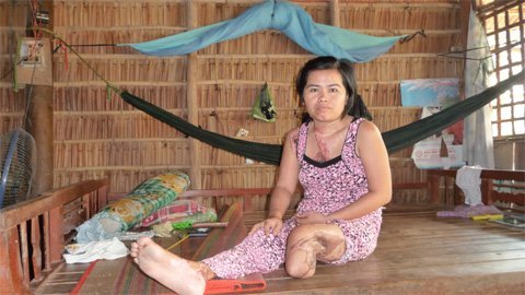 Tôi chỉ ước có tiền gắn chân giả để phụ chồng nuôi hai con