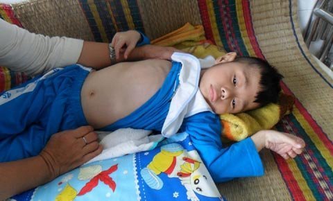 Mẹ rửa chén thuê nuôi con 7 năm nằm viện