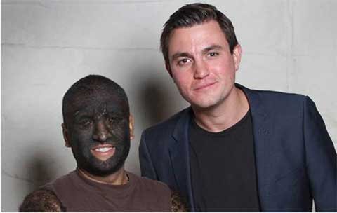 Phụ nữ mê mẩn người đàn ông lông lá nhất thế giới