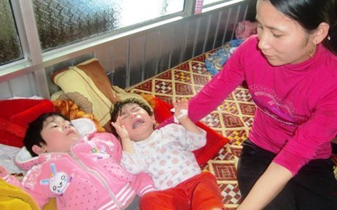 Rơi nước mắt trước 2 cháu bé bại não…