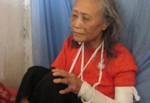 Sổng 3 con chào mào, con đánh mẹ gãy tay