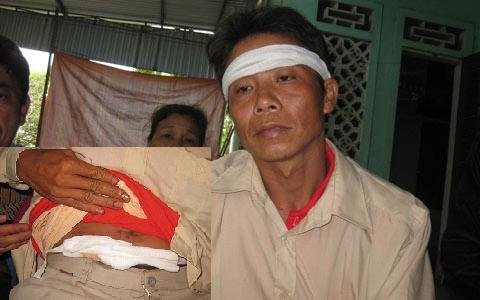 Lời kể người thoát chết trên chiếc xe 'tử thần'