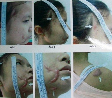 Chích điện cố sát vợ, gã thợ hồ bị truy tố