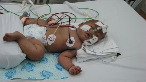 Thương cảm bé gái người Mông chống chọi với viêm màng não