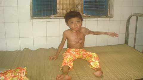 Trao hơn 6 triệu đồng đến bé Nguyễn Thị Hồng Nhung