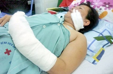 Ghen tuông, cụ bà 73 vác dao chém tình địch