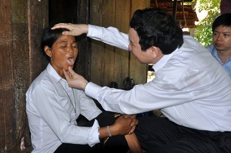 Bệnh lạ Quảng Ngãi: Bước đầu xác định là do virút Ríckets