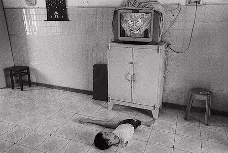 Phóng sự ảnh gây sốc về nỗi đau da cam