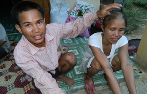Thêm ca tử vong, 'biến thành bà lão' vì bệnh lạ
