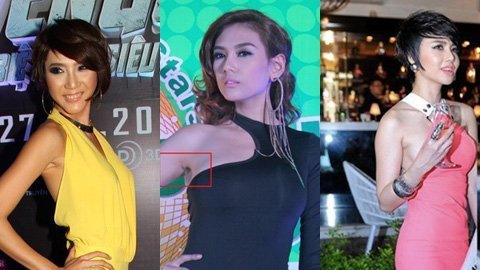 Sao Việt hớ hênh để lộ dấu tích dao kéo