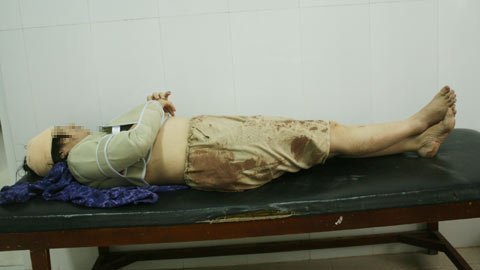 Bị chồng đánh giữa đêm, vợ nhảy lầu bất tỉnh