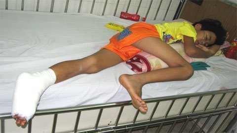 Tương lai mờ mịt của bé bị rắn cắn