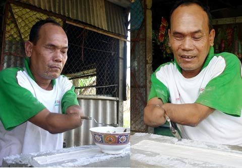 Sự vươn lên khó tin người họa sĩ cụt 2 tay