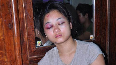 Chàng rể gọi côn đồ đánh vợ và mẹ nhập viện