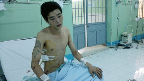 Bảo vệ thuê giang hồ vào bệnh viện chém người