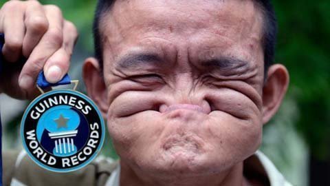 Người đàn ông 'mặt xoắn' nhất thế giới