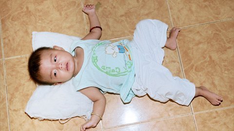 Nỗi đau người mẹ trẻ không tiền mổ tim cứu con