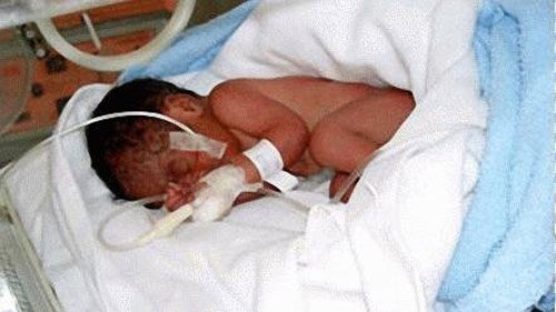 Thai nhi 37 tuần tử vong do... bất khả kháng?