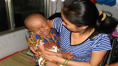 Hết tiền cũng phải liều… trốn viện