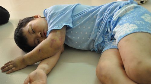 Nhức nhối cha mẹ 'ra đòn' tàn nhẫn với con