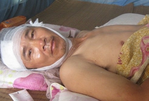 20 côn đồ truy sát người dân Văn Giang