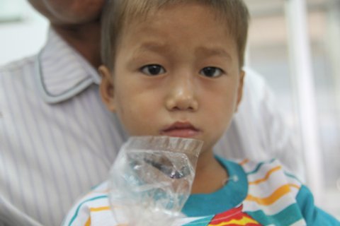Lấy con vắt 'khủng' trong khí quản bệnh nhân nhí