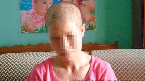 Muốn con lấy được chồng, tiêm thuốc chữa hói thối cả thịt