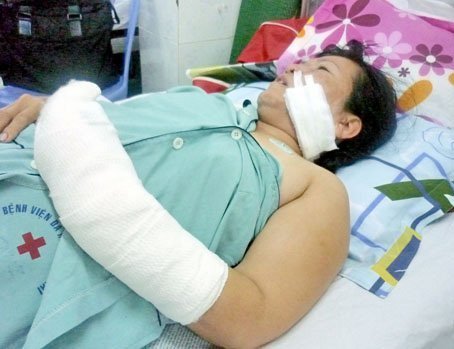Chiêu trả thù đáng sợ của 