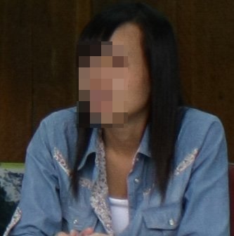 Chuyện trầy trật làm vợ của người có 'cô bé' dị dạng