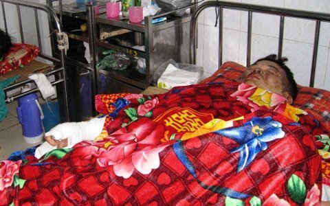 Thai phụ bị chồng thiêu sống ngay sau tuần trăng mật