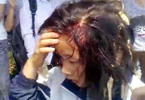 Sau lễ tổng kết, nữ sinh choảng nhau tóe máu