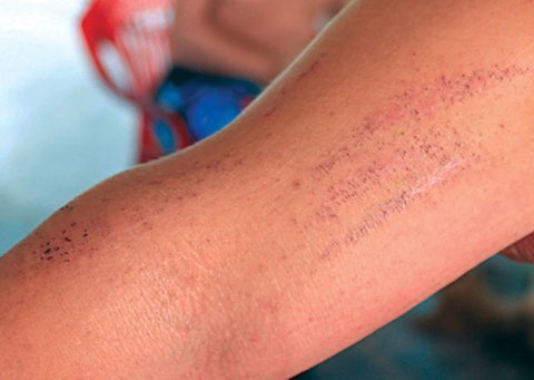 Ngư dân hoang mang vì bướm lạ tấn công