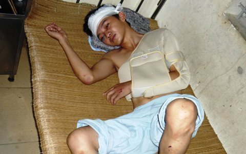 Bịt mặt vào công viên cướp và đánh đôi tình nhân