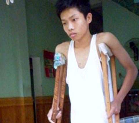 Mất chân vì ê kíp y bác sĩ trực tắc trách