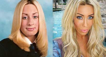 Phẫu thuật thẩm mỹ 18 lần trong 7 năm