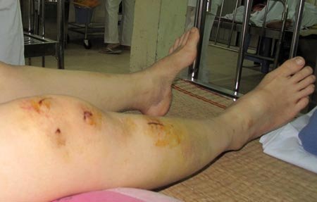Vợ ăn đòn vì không biết cách làm cho chồng… lên đỉnh