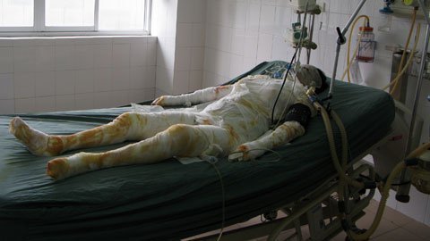 Nóng trong ngày: Cháu đích tôn đốt 11 người