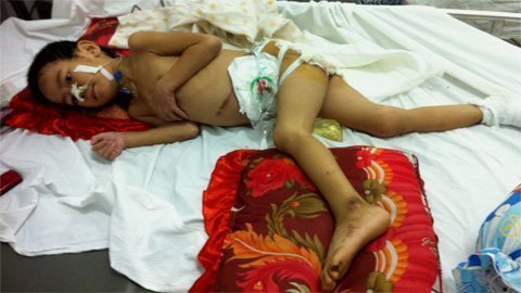 Nước mắt người đàn ông nuôi con ung thư