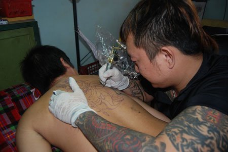 Biến tướng của thú chơi xăm mình: Cấy đá vào da thịt
