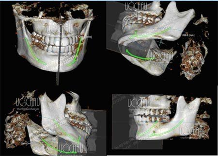 Dừng đèn đỏ quá lâu dưới nắng nóng có thể chết người