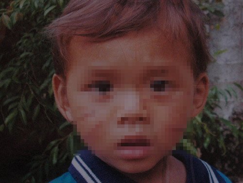 Nhiều lần rạch mặt bé 2 tuổi vì ghen “gió”