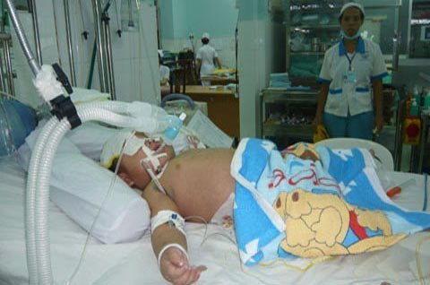 Bệnh hô hấp tăng cao, tay chân miệng phức tạp