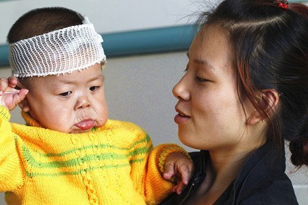 Bé một tuổi rưỡi trông như bà lão