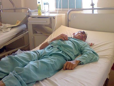Đi săn, bị kim loại xuyên thủng hộp sọ