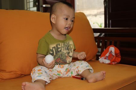 Kỳ lạ bé 17 tháng tuổi cử động hai tay như một