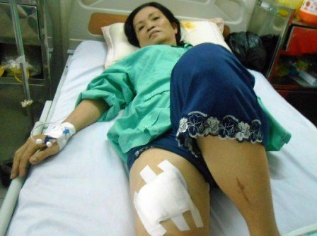 Vờ mua hàng, cố sát chủ quán tạp hóa để cướp